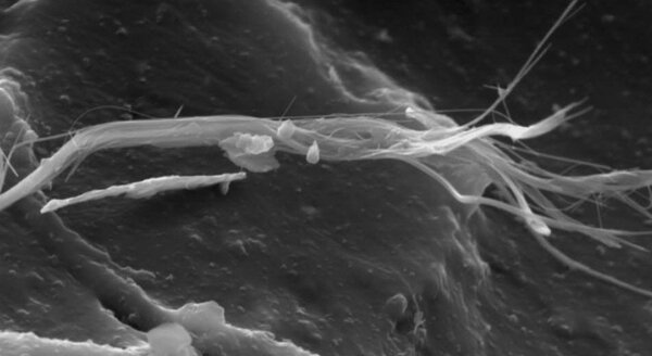 Adhesive on Flor-Flex board, asbestos fibers | © CRB Analyse Service GmbH